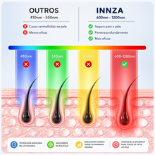 Carregar imagem no visualizador da galeria, Depilador a Laser IPL INNZA