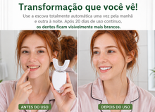 Carregar imagem no visualizador da galeria, ZenTouch 360 - Escova Elétrica