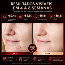 Carregar imagem no visualizador da galeria, Máscara LED Therapy M300
