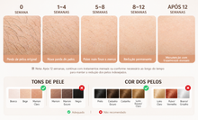 Carregar imagem no visualizador da galeria, Depilador a Laser IPL INNZA
